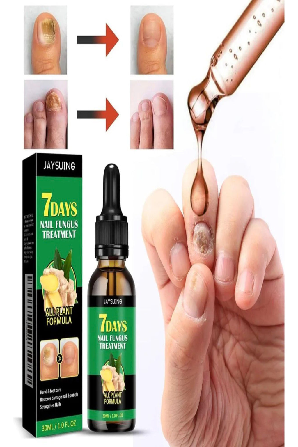 TRATAMIENTO 7 DIAS-NO MAS HONGOS !