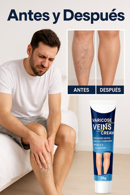 Crema para Varices VEINS